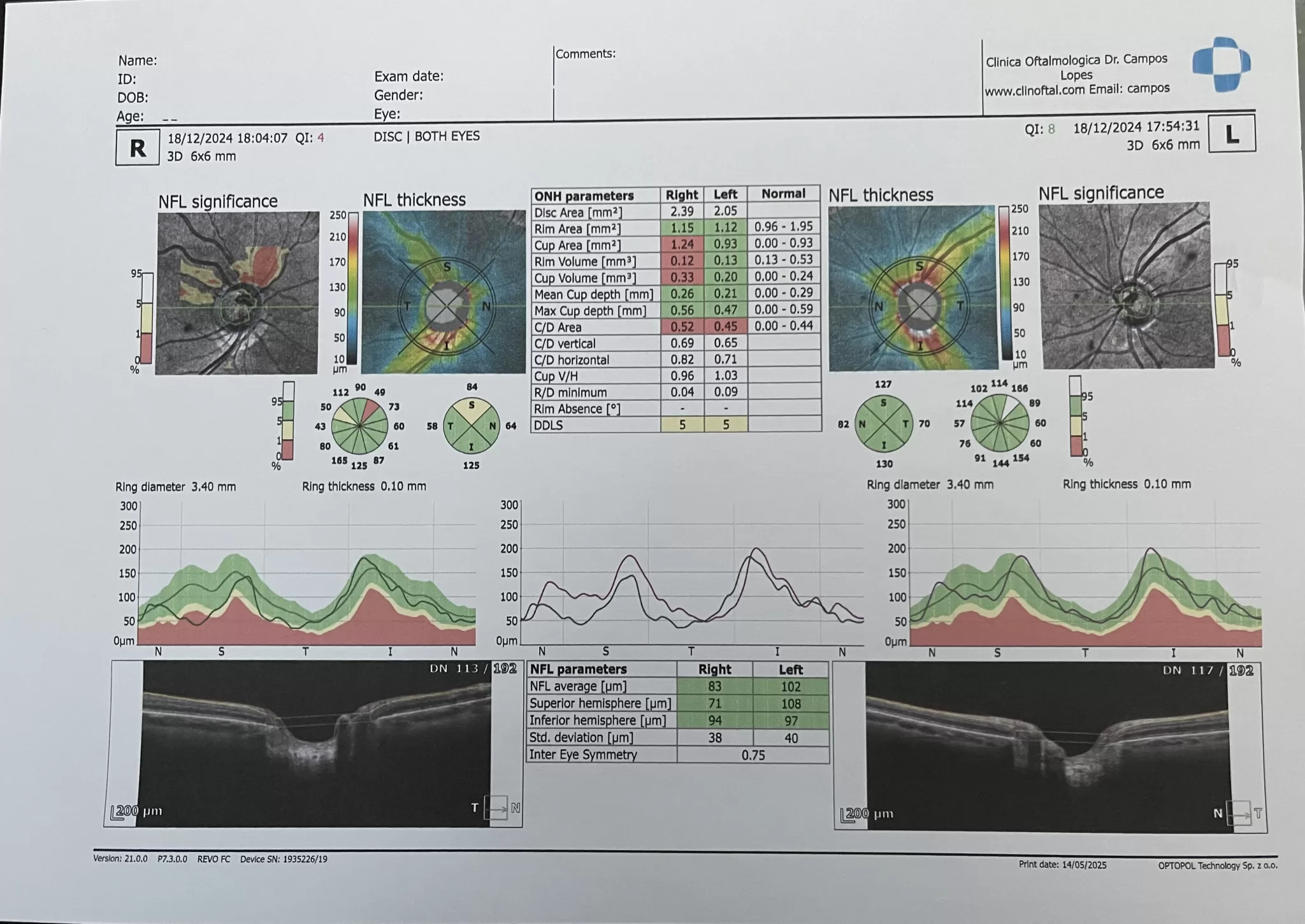 Figura 12 OCT imagens e a IA