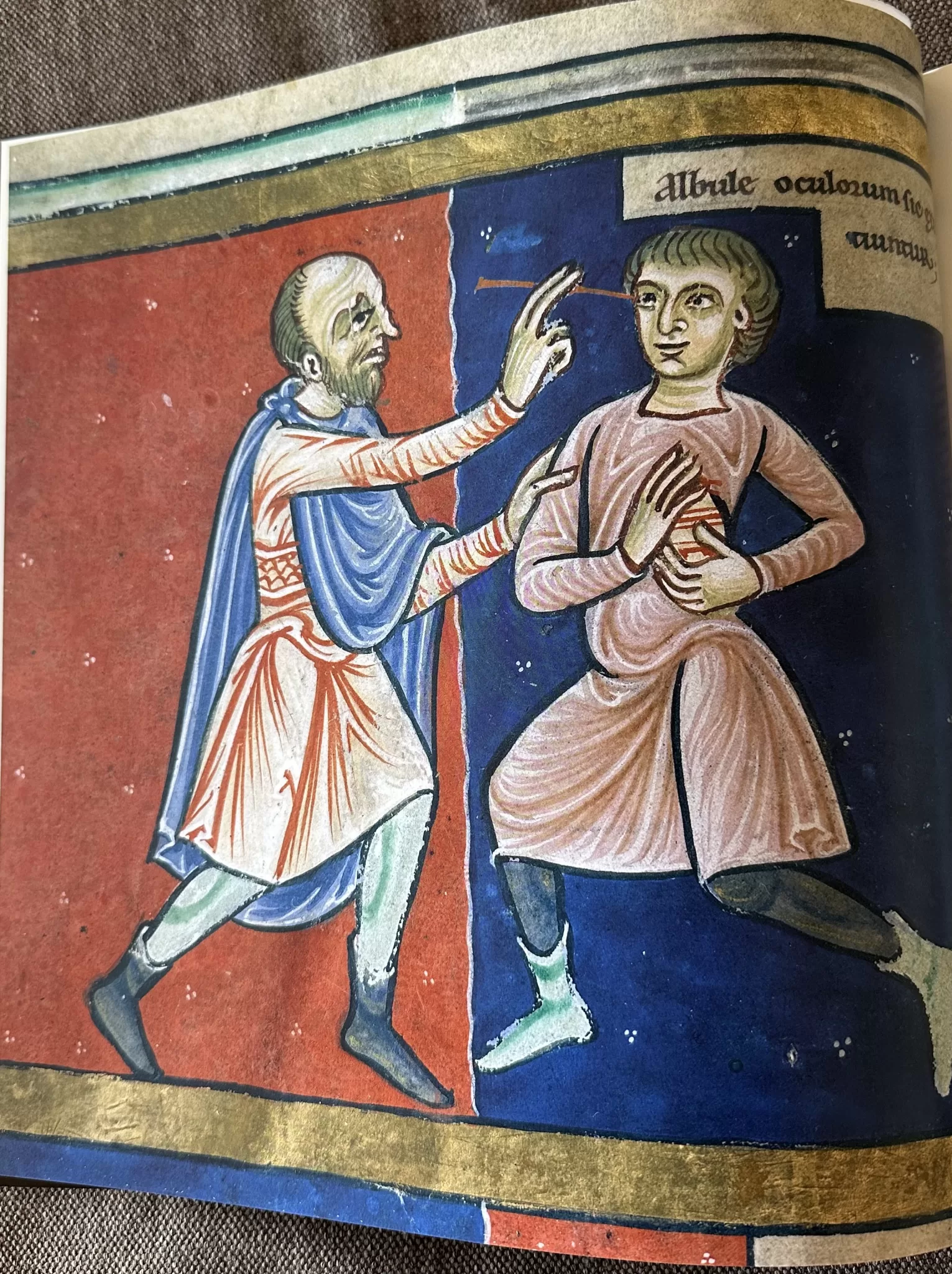 Figura 6 Cirurgia a cataratas manuscrito da Bodleian Library Oxford